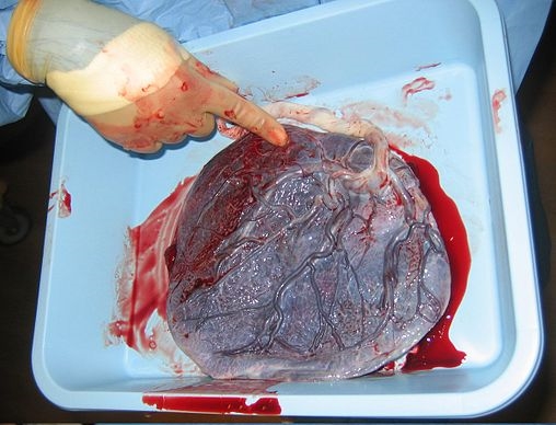 placenta-porcao-fetal