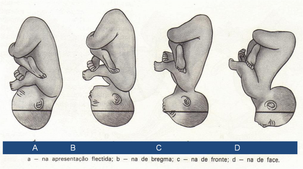 Trabalho De Parto Rápido Como Ter Casa Da Doula 