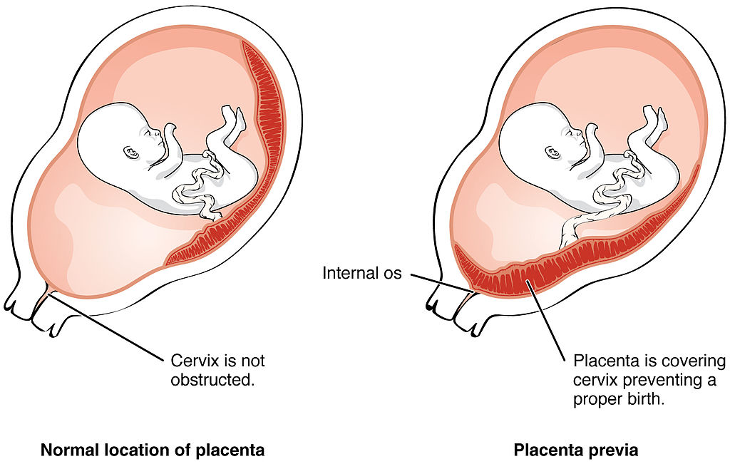 Quando A Ces rea Bem vinda Indica es Reais Casa Da Doula