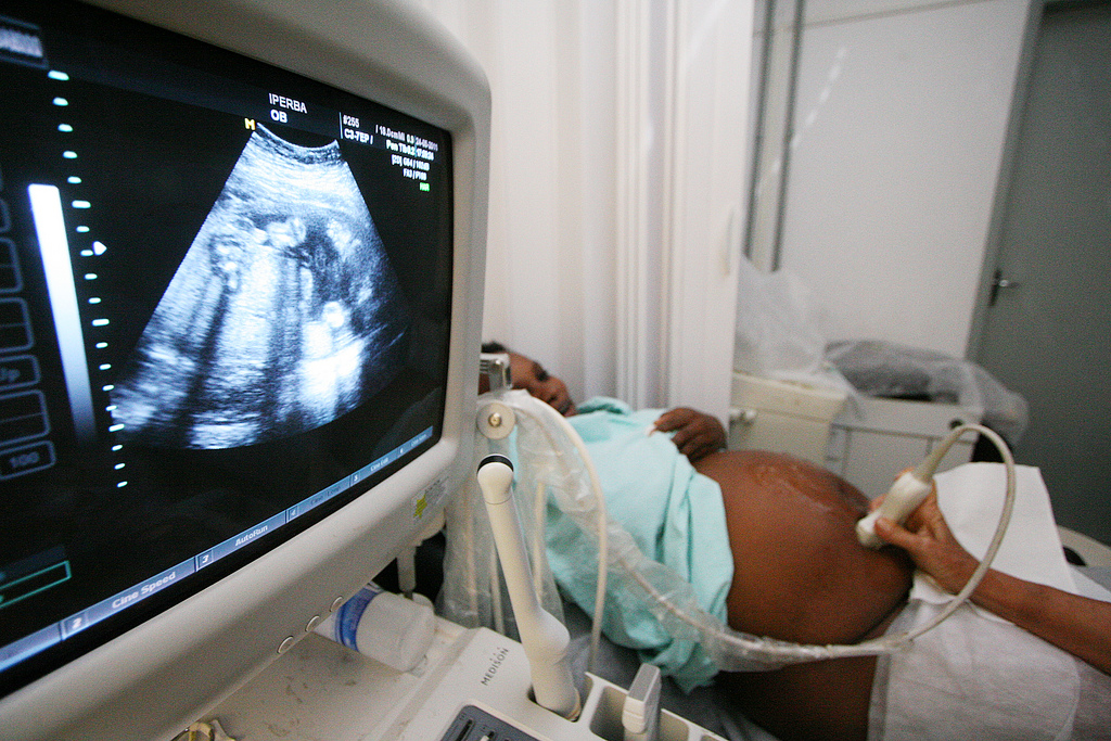 exame de ultrasson na gestação