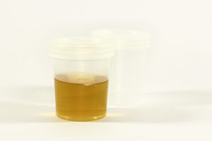 exame de urina