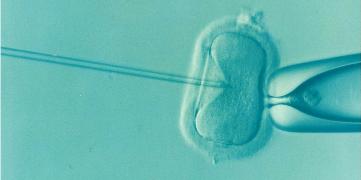 Minha história de fertilização in vitro