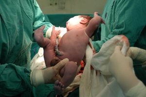 Quem faz parto é obstetra