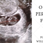 O que é percentil fetal?