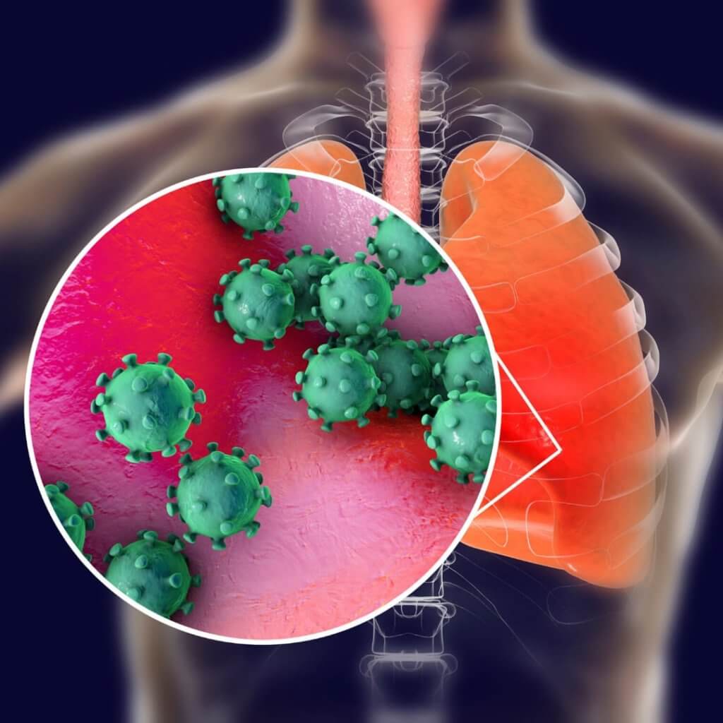 A Síndrome Respiratóia Aguda Grave pode ser causada por coronavírus. Foto: biblioteca Canva